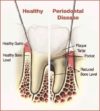 Are your gums healthy?